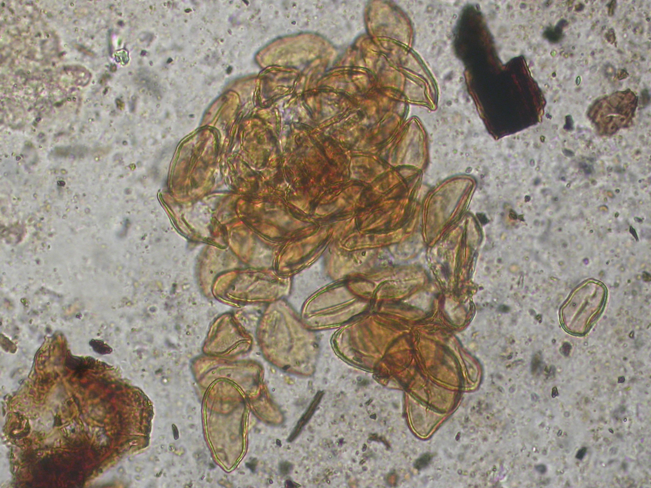 Pollen Pléistocène de Rubiacé